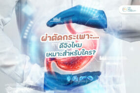 ผ่าตัดกระเพาะ-EWC